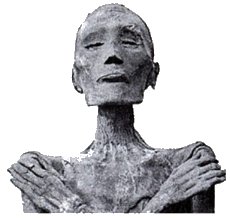 Imagen que muestra la momia de Ramsés V, que murió de viruela